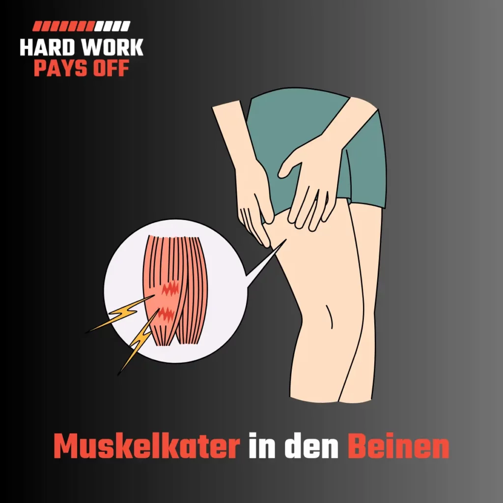 beinmuskelkater-muskelkater-in-den-beinen